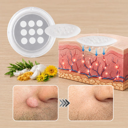 ✨PURESHADE® 2 az 1-ben mikrotűs és hidrokolloid tapasz🍀 | Kiálló anyajegyek, aknék, lapos szemölcsök és bőrnövedékek eltávolítására | Segít csökkenteni a ráncokat, hegeket és bőrhibákat | Láthatatlan tapasz az arcra és testre