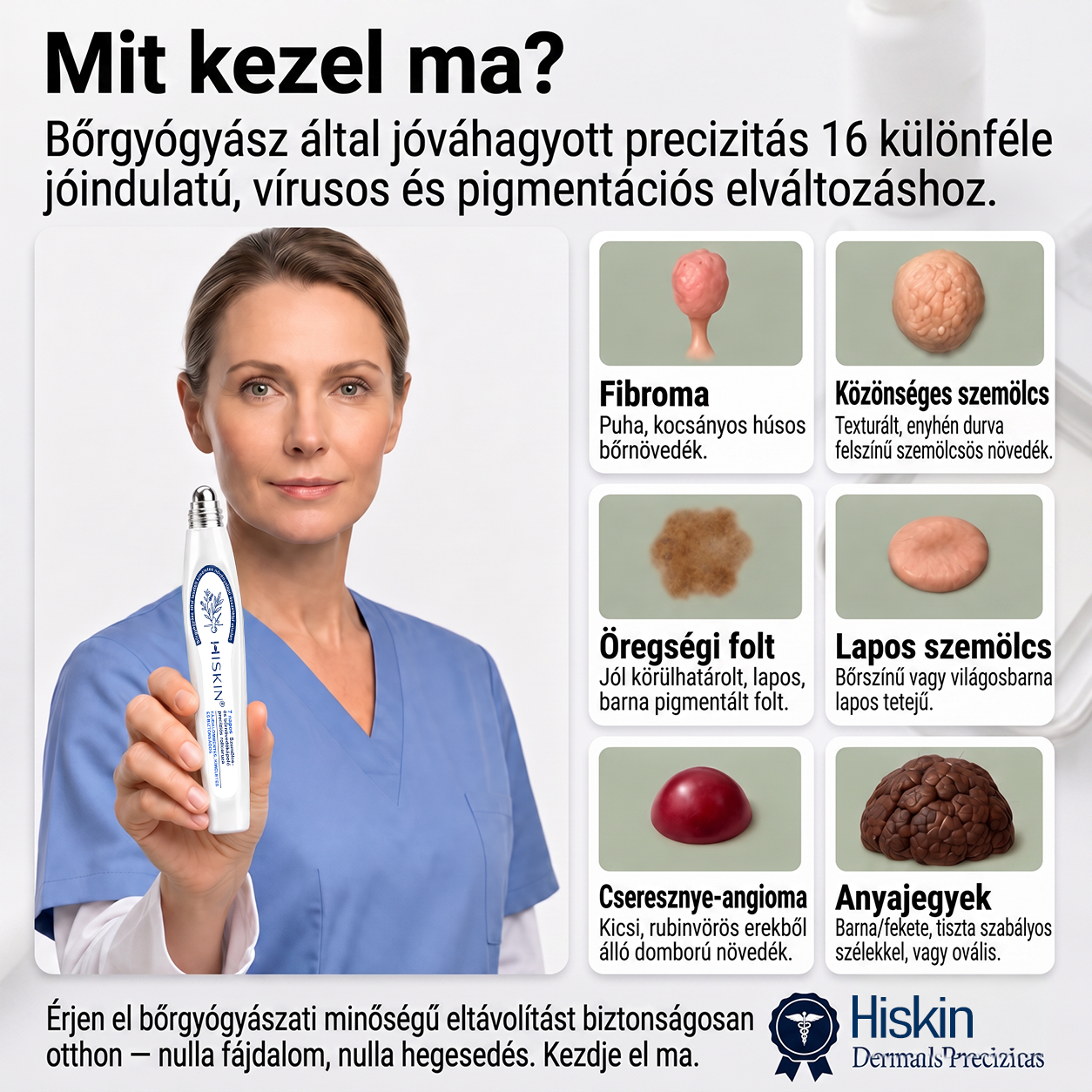 💎Hivatalos Márkabolt | 🚢🚢 Hiskin® 7 napos Szemölcseltávolító Roll-on Ápoló Folyadék (Fájdalommentes rollerball technológia, hegek nélkül) 🐬
