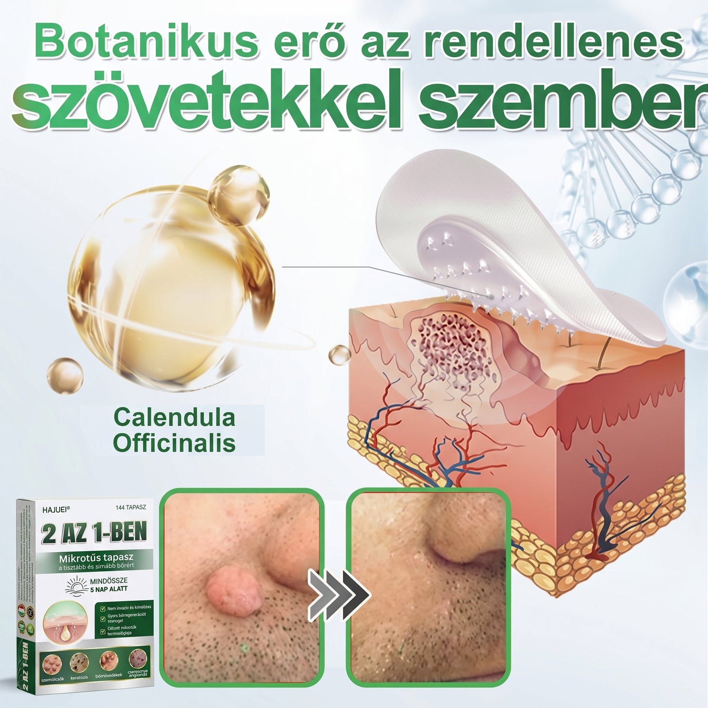 🇭🇺HAJUEI® ☺️ 2-az-1-ben Mikrotű & Hidrokoloid Tapasz | 🧪 Kiemelkedő Anyajegyek, Pattanások, Lapos Szemölcsök & Bőrkinövések Eltávolítója | Ráncok, Hegek & Bőrhibák Javítása | Láthatatlan Csillag Pattanástapasz Arcra & Testre | 144 db ✨