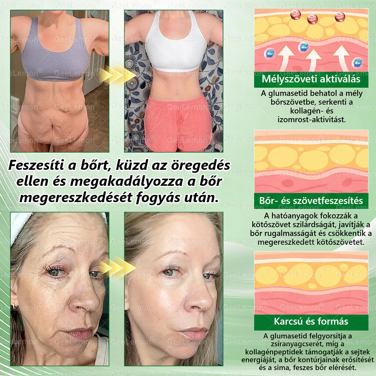 💚GeeLemon® Glumasetide 8 az 1-ben Nano Mikrotűs Karcsúsító Tapasz