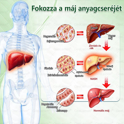 💚🍃GeeLemon® Glumasetide 8 az 1-ben Nano Mikrotűs Karcsúsító Tapasz