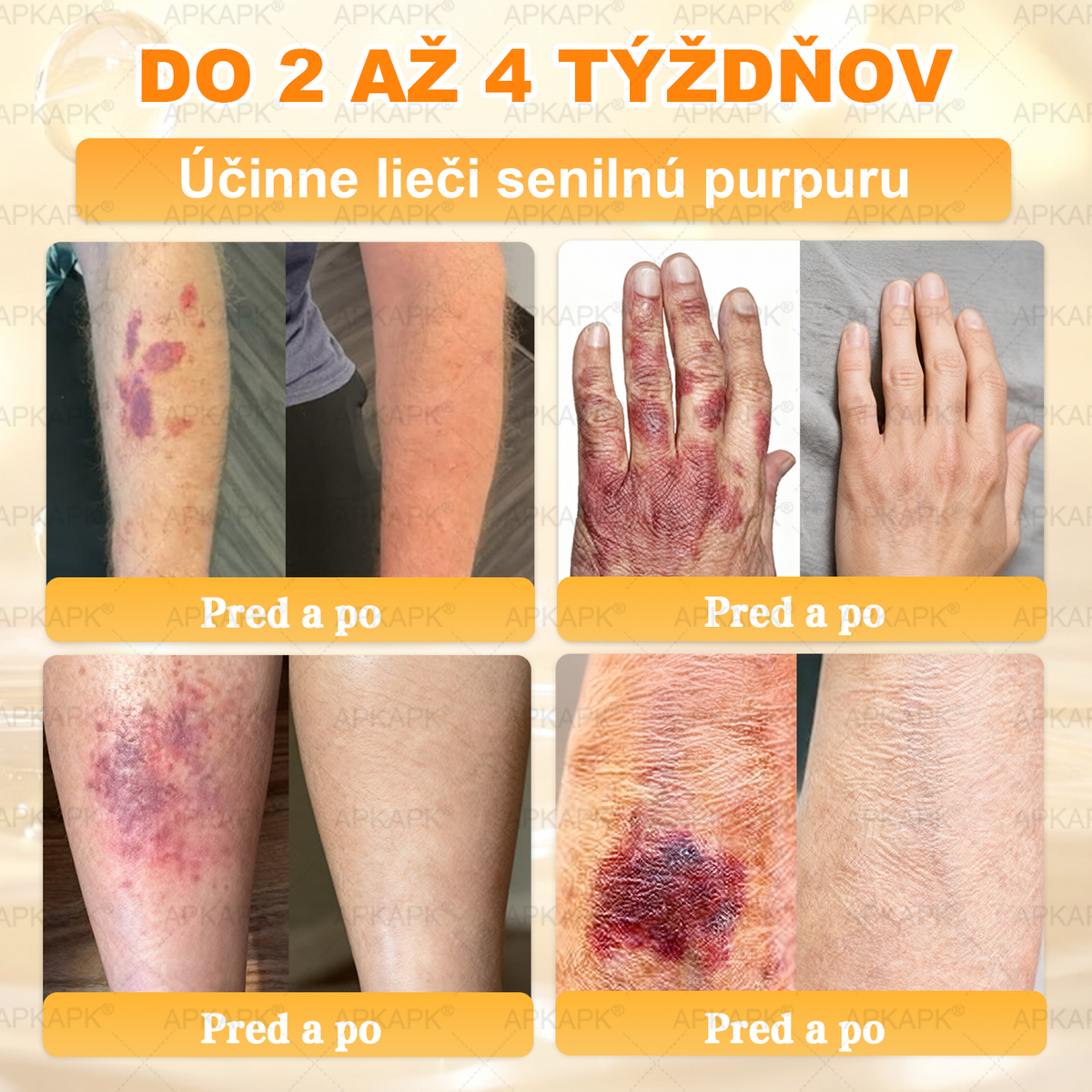 Vyrobené na Slovensku✨✨ 𝖠𝖯𝖪𝖠𝖯𝖪® regeneračný krém na pokožku s včelím jedom