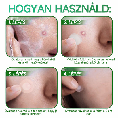 🇭🇺HAJUEI® ☺️ 2-az-1-ben Mikrotű & Hidrokoloid Tapasz | 🧪 Kiemelkedő Anyajegyek, Pattanások, Lapos Szemölcsök & Bőrkinövések Eltávolítója | Ráncok, Hegek & Bőrhibák Javítása | Láthatatlan Csillag Pattanástapasz Arcra & Testre | 144 db ✨