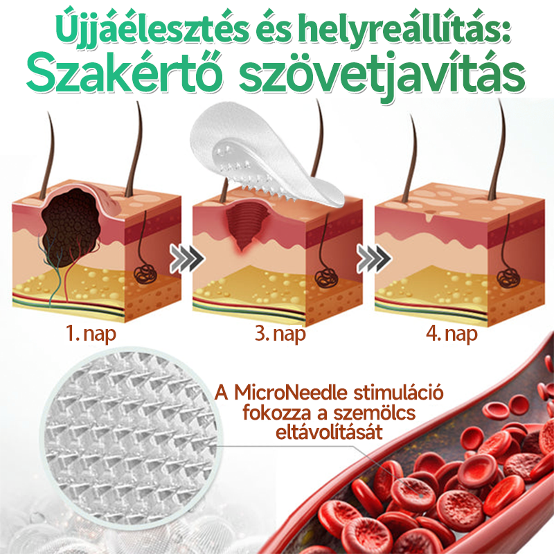 🇭🇺HAJUEI® ☺️ 2-az-1-ben Mikrotű & Hidrokoloid Tapasz | 🧪 Kiemelkedő Anyajegyek, Pattanások, Lapos Szemölcsök & Bőrkinövések Eltávolítója | Ráncok, Hegek & Bőrhibák Javítása | Láthatatlan Csillag Pattanástapasz Arcra & Testre | 144 db ✨