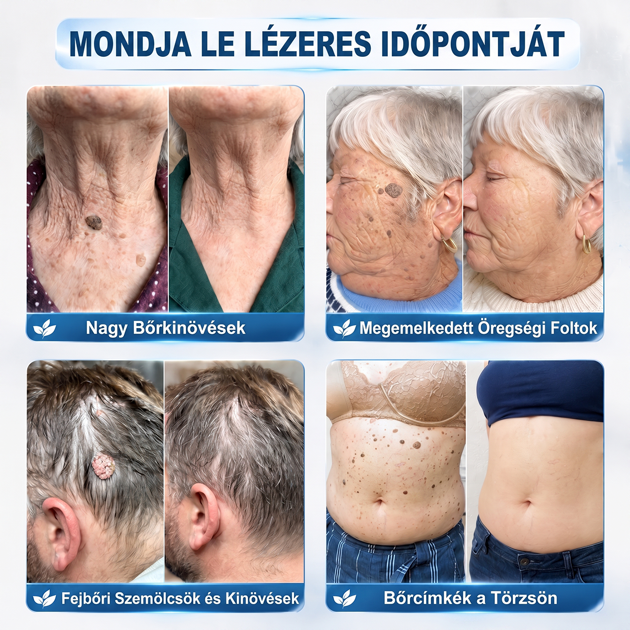 🎁 🎁Már csak 5 doboz maradt! Most további 50% kedvezményt adunk! Legyél fitt és egészséges. Ha most nem élsz a lehetőséggel, legközelebb csak jövőre lesz rá esélyed!