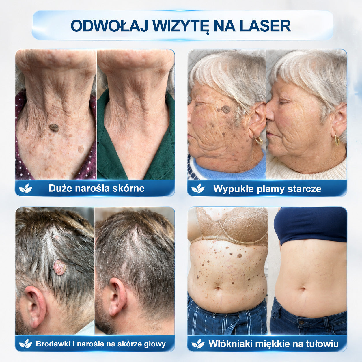 🍀🍀🍀Hiskin® 7 𝑫𝒏𝒊 𝑷𝒓𝒆𝒑𝒂𝒓𝒂𝒕 𝑫𝒐 𝑼𝒔𝒖𝒘𝒂𝒏𝒊𝒂 𝑾łó𝒌𝒏𝒊𝒂𝒌ó𝒘 𝑴𝒊ę𝒌𝒌𝒊𝒄𝒉 𝑰 𝑷𝒓𝒛𝒆𝒃𝒂𝒓𝒘𝒊𝒆ń(𝐁𝐞𝐳 𝐁ó𝐥𝐮, 𝐁𝐞𝐳 𝐁𝐥𝐢𝐳𝐧 – 𝐑𝐨𝐥𝐥-𝐨𝐧)