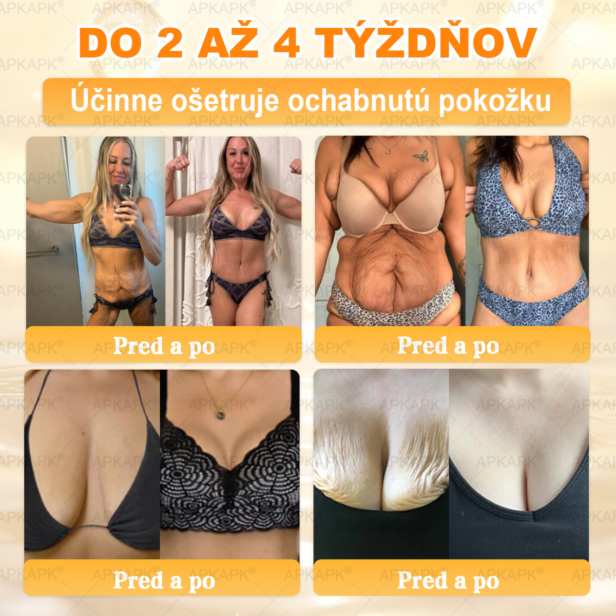 Vyrobené na Slovensku✨✨ 𝖠𝖯𝖪𝖠𝖯𝖪® regeneračný krém na pokožku s včelím jedom