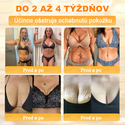 Vyrobené na Slovensku✨✨ 𝖠𝖯𝖪𝖠𝖯𝖪® regeneračný krém na pokožku s včelím jedom