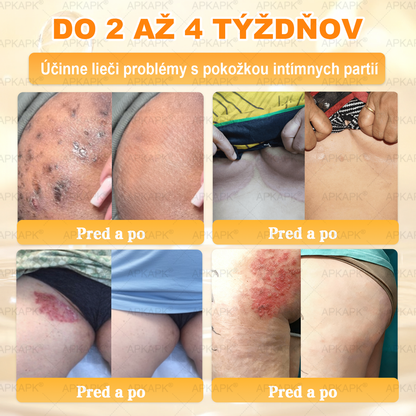 Odporúčané Univerzitnou nemocnicou Bratislava · Vyrobené na Slovensku✨✨ 𝖠𝖯𝖪𝖠𝖯𝖪® regeneračný krém na pokožku s včelím jedom