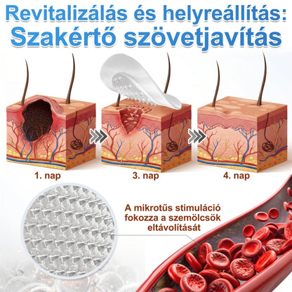 ✨PURESHADE® 2 az 1-ben mikrotűs és hidrokolloid tapasz🍀 | Kiálló anyajegyek, aknék, lapos szemölcsök és bőrnövedékek eltávolítására | Segít csökkenteni a ráncokat, hegeket és bőrhibákat | Láthatatlan tapasz az arcra és testre
