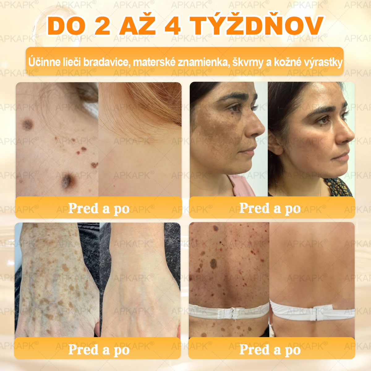 Vyrobené na Slovensku✨✨ 𝖠𝖯𝖪𝖠𝖯𝖪® regeneračný krém na pokožku s včelím jedom