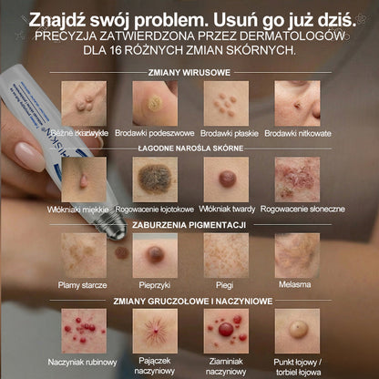 🍀🍀🍀Hiskin® 7 𝑫𝒏𝒊 𝑷𝒓𝒆𝒑𝒂𝒓𝒂𝒕 𝑫𝒐 𝑼𝒔𝒖𝒘𝒂𝒏𝒊𝒂 𝑾łó𝒌𝒏𝒊𝒂𝒌ó𝒘 𝑴𝒊ę𝒌𝒌𝒊𝒄𝒉 𝑰 𝑷𝒓𝒛𝒆𝒃𝒂𝒓𝒘𝒊𝒆ń(𝐁𝐞𝐳 𝐁ó𝐥𝐮, 𝐁𝐞𝐳 𝐁𝐥𝐢𝐳𝐧 – 𝐑𝐨𝐥𝐥-𝐨𝐧)