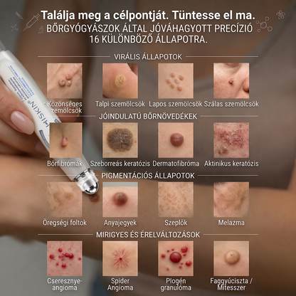 💎Hivatalos Márkabolt | 🚢🚢 Hiskin® 7 napos Szemölcseltávolító Roll-on Ápoló Folyadék (Fájdalommentes rollerball technológia, hegek nélkül) 🐬