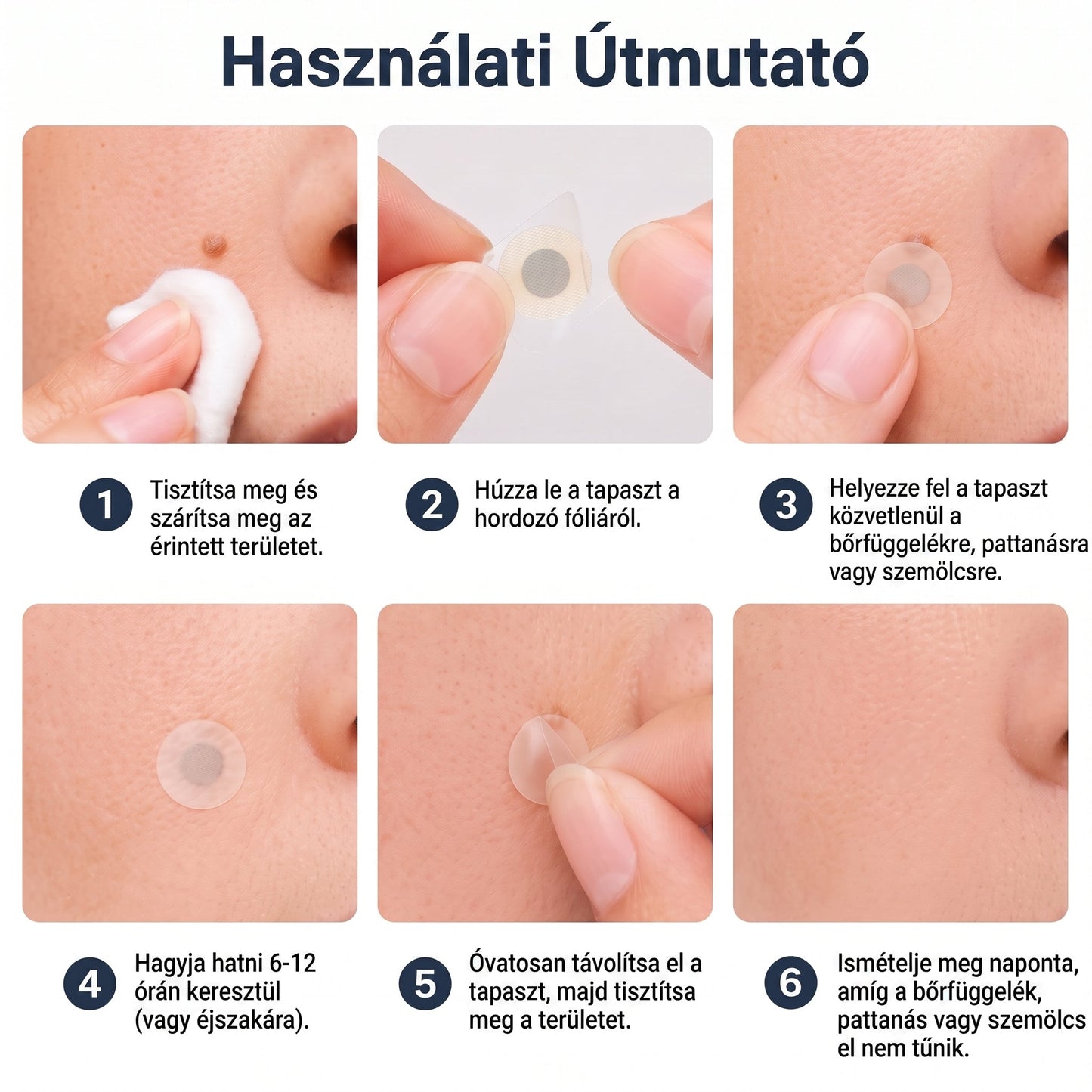 ✨PURESHADE® 2 az 1-ben mikrotűs és hidrokolloid tapasz🍀 | Kiálló anyajegyek, aknék, lapos szemölcsök és bőrnövedékek eltávolítására | Segít csökkenteni a ráncokat, hegeket és bőrhibákat | Láthatatlan tapasz az arcra és testre