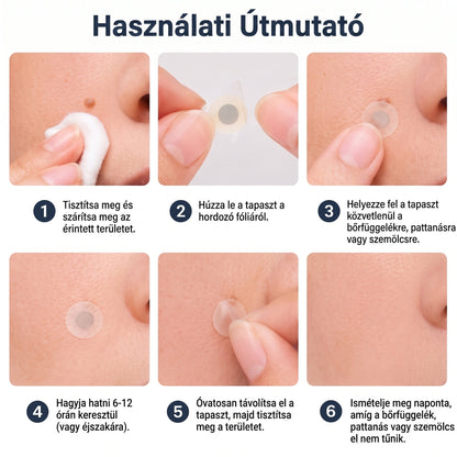✨PURESHADE® 2 az 1-ben mikrotűs és hidrokolloid tapasz🍀 | Kiálló anyajegyek, aknék, lapos szemölcsök és bőrnövedékek eltávolítására | Segít csökkenteni a ráncokat, hegeket és bőrhibákat | Láthatatlan tapasz az arcra és testre