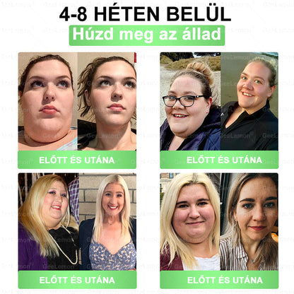 🔥GeeLemon® Glumasetide 8 az 1-ben Nano Mikrotűs Karcsúsító Tapasz