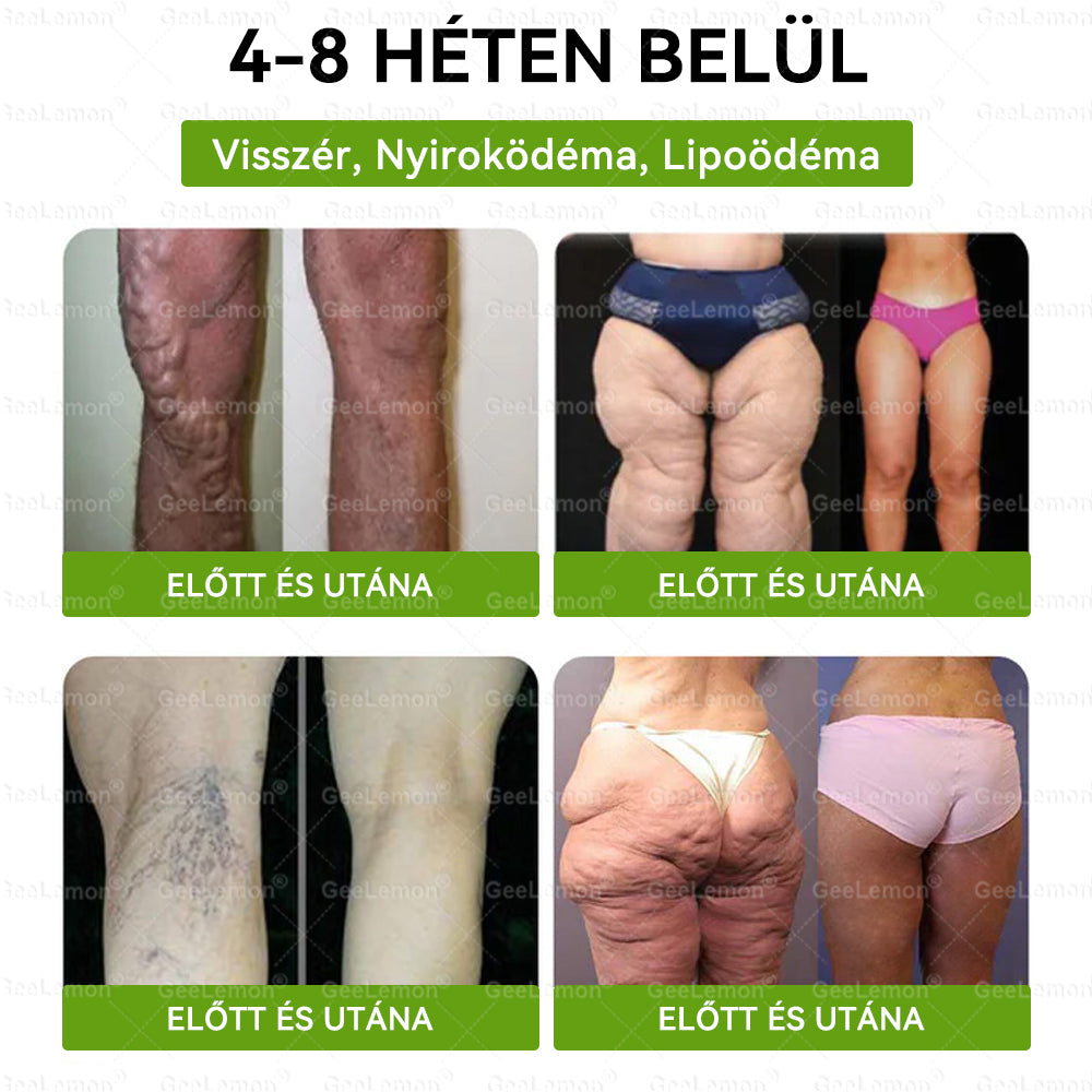 ✅💪GeeLemon® Glumasetide 8 az 1-ben Nano Mikrotűs Karcsúsító Tapasz