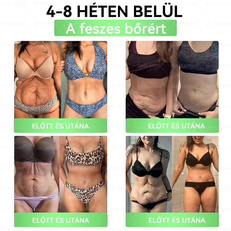 👉👉GeeLemon® Glumasetide 8 az 1-ben Nano Mikrotűs Karcsúsító Tapasz