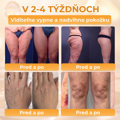 Vyrobené na Slovensku✨✨ 𝖠𝖯𝖪𝖠𝖯𝖪® regeneračný krém na pokožku s včelím jedom