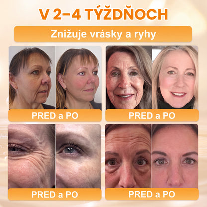 Vyrobené na Slovensku✨✨ 𝖠𝖯𝖪𝖠𝖯𝖪® regeneračný krém na pokožku s včelím jedom